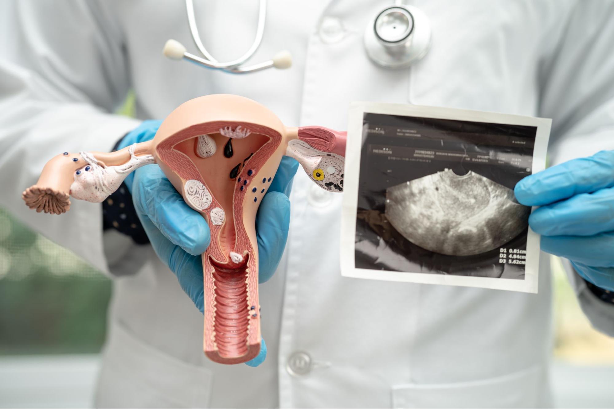 doctor holding Cervical screening scan